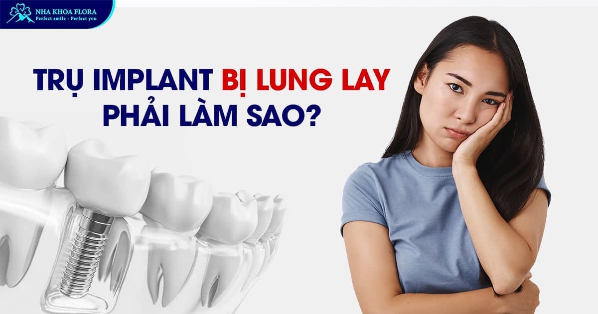 trụ implant bị lung lay