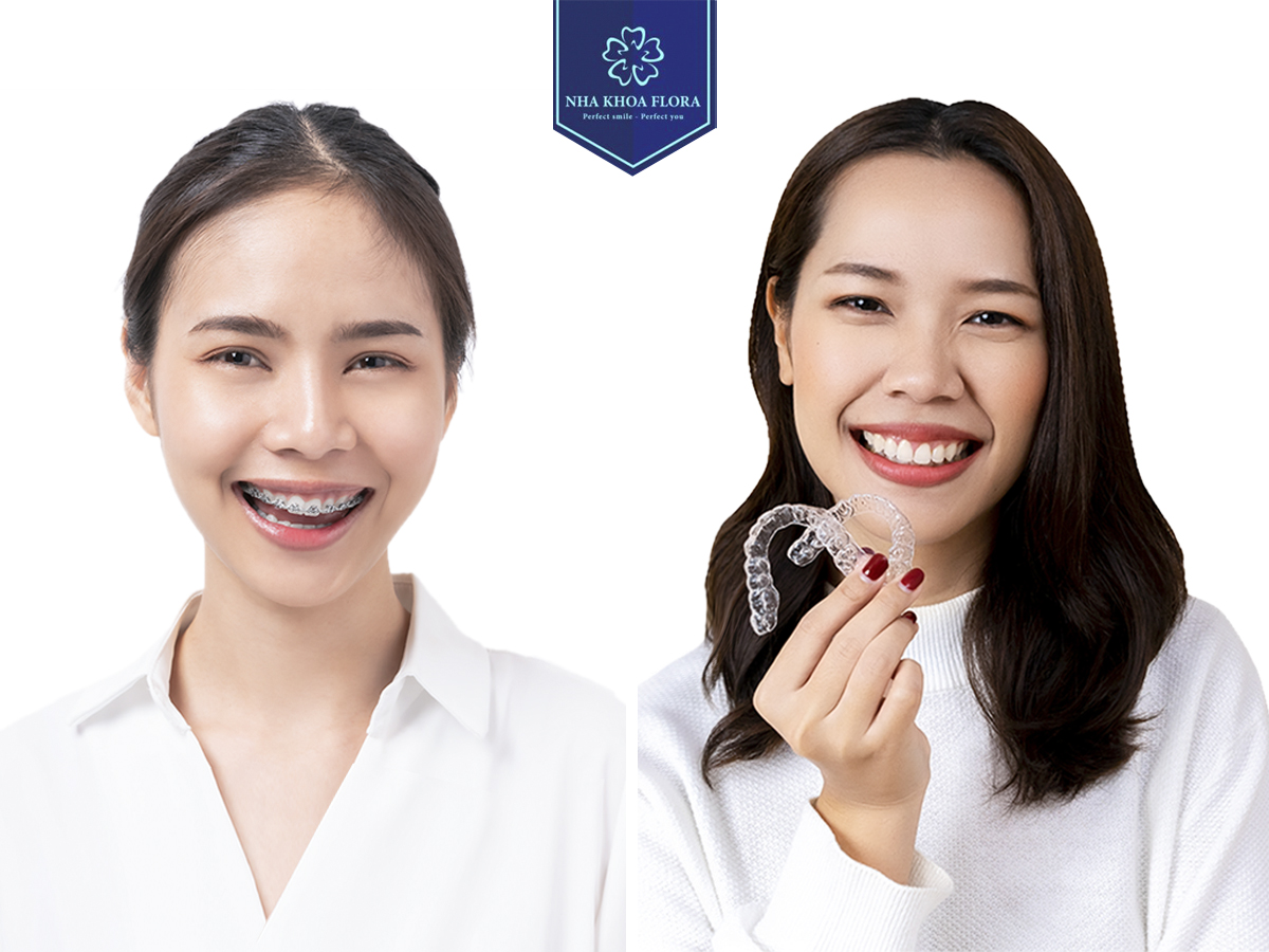 Customers using braces services