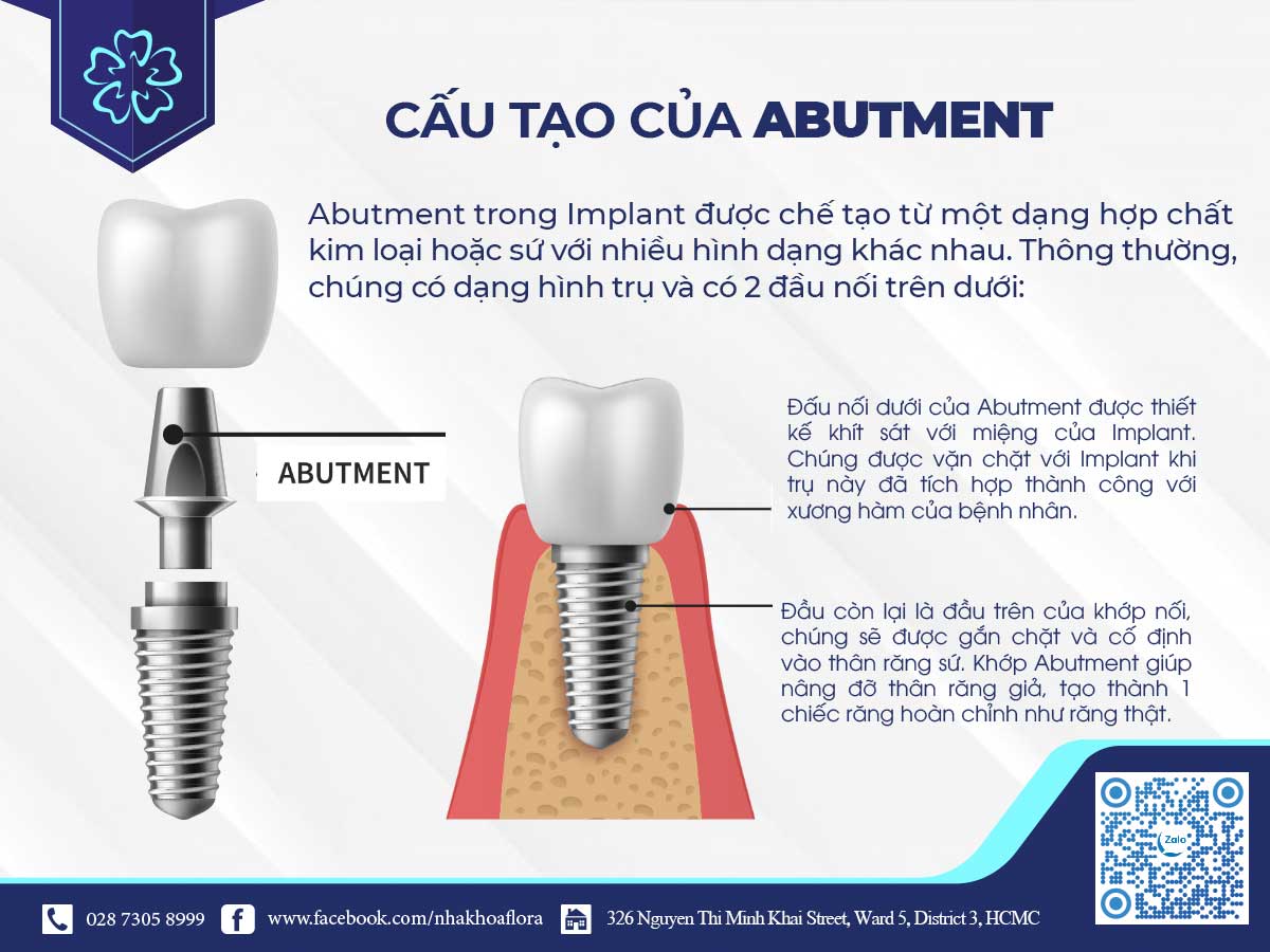 cấu tạo của khớp nối Implant Abutment