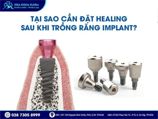 Healing Implant - ảnh 4
