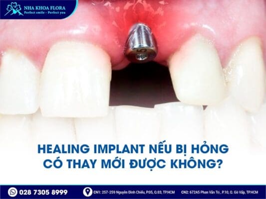 Healing Implant - ảnh 5