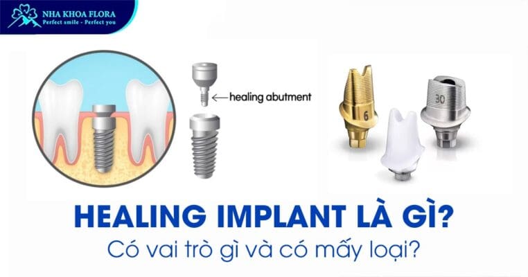 Healing Implant