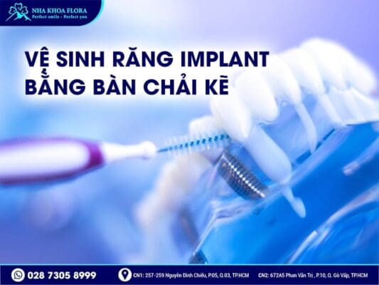 Cách vệ sinh răng Implant - ảnh 2