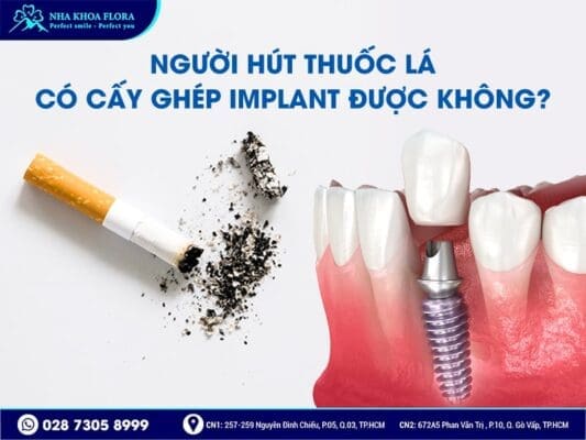 trồng răng Implant có hút thuốc được không - ảnh 2